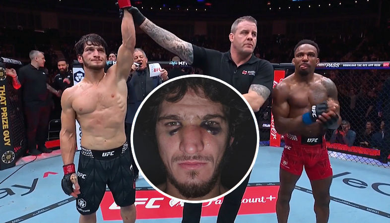 Movsar Evloev doznał poważnego urazu na 4 tygodnie przed walką z Leronem Murphym na UFC Londyn